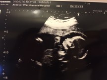 1395D322-2504-45D2-A4DB-C34A29865538