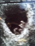 8C63E269-CA9C-483C-A0FE-B2A6797E69EB