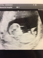 DF48D6EA-BBE9-4402-806A-81853E5C58F7